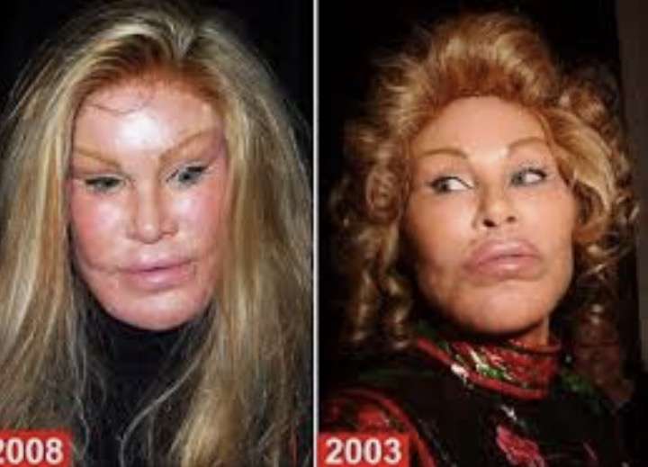 長谷川京子、「唇に違和感が…」アヒル口の自撮り写真に話題騒然