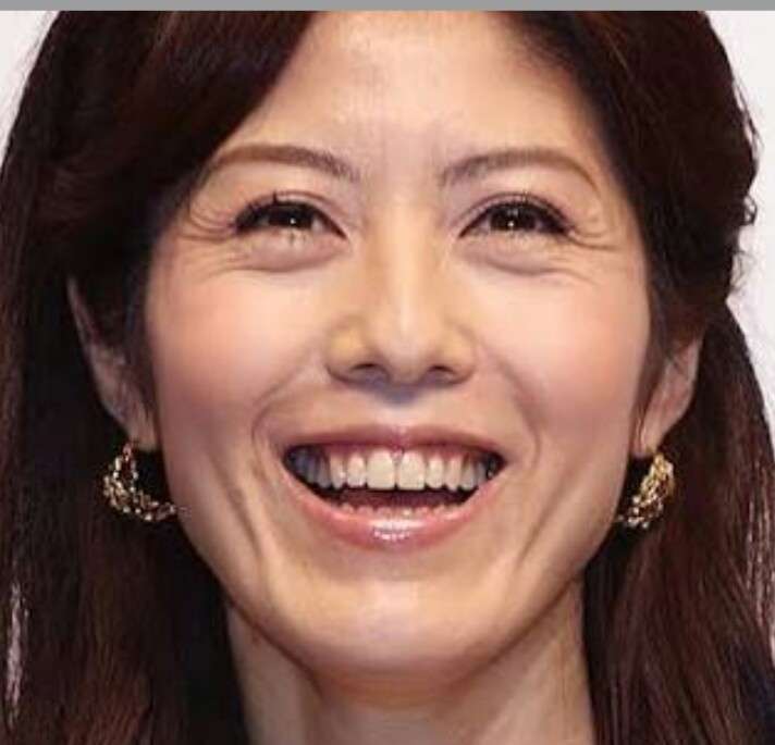 松井珠理奈　劇場公演に登場！82日ぶりにファンの前に姿　7日のＭステで仕事復帰！