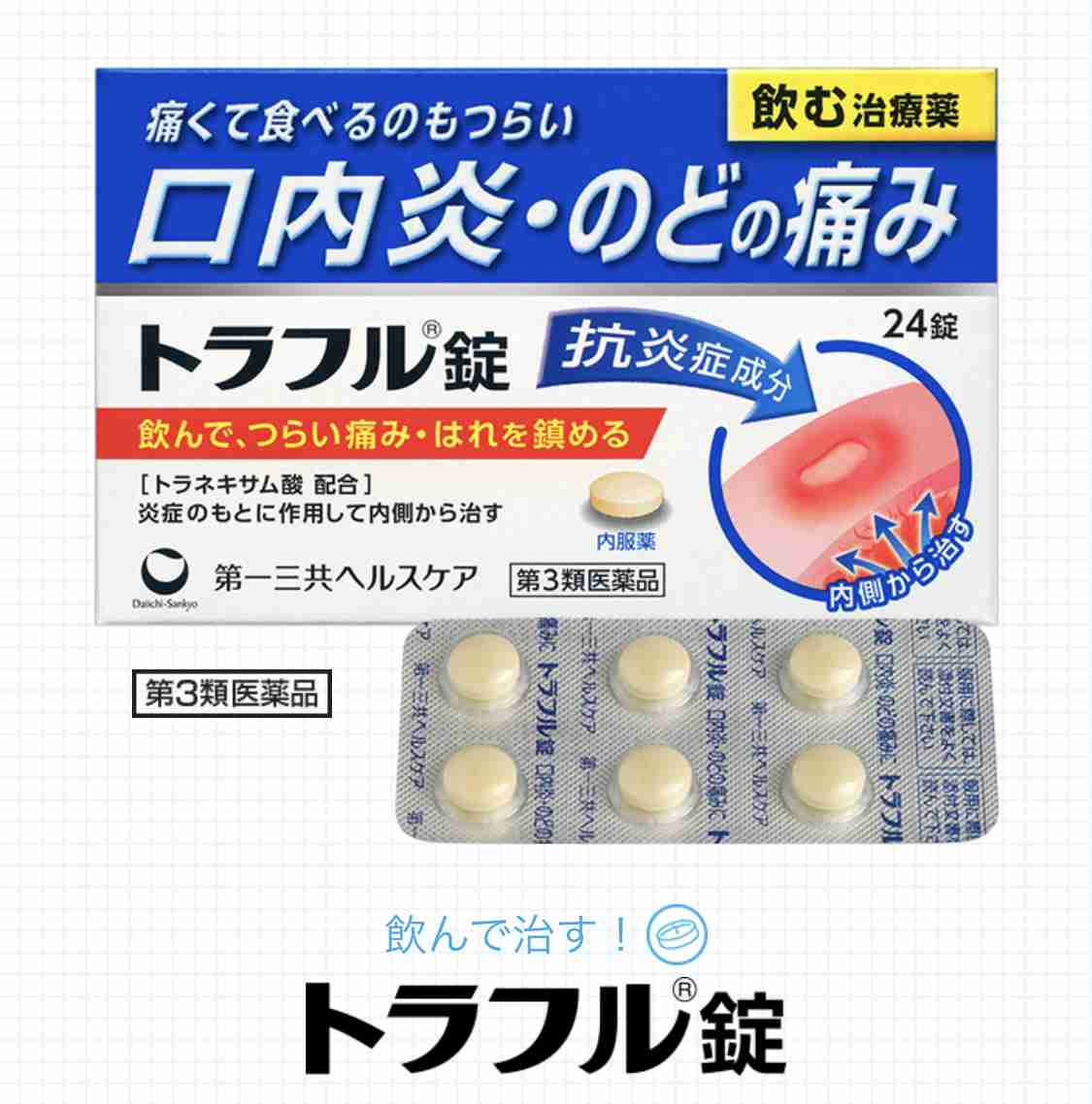 口内炎