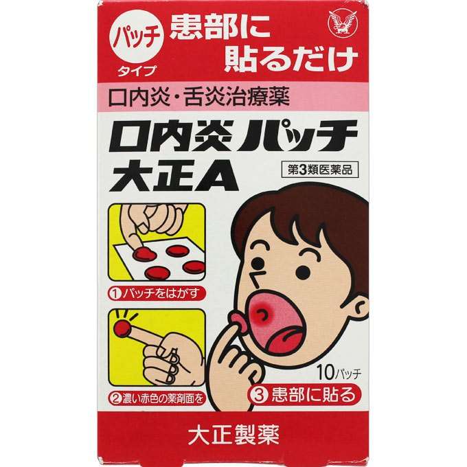 口内炎