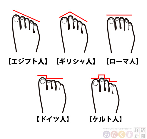 外反母趾がつらい人〜！