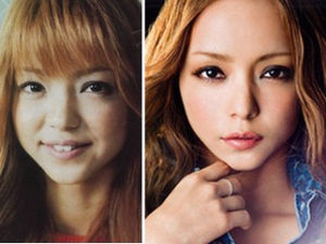 お金で美貌は手に入りますか？