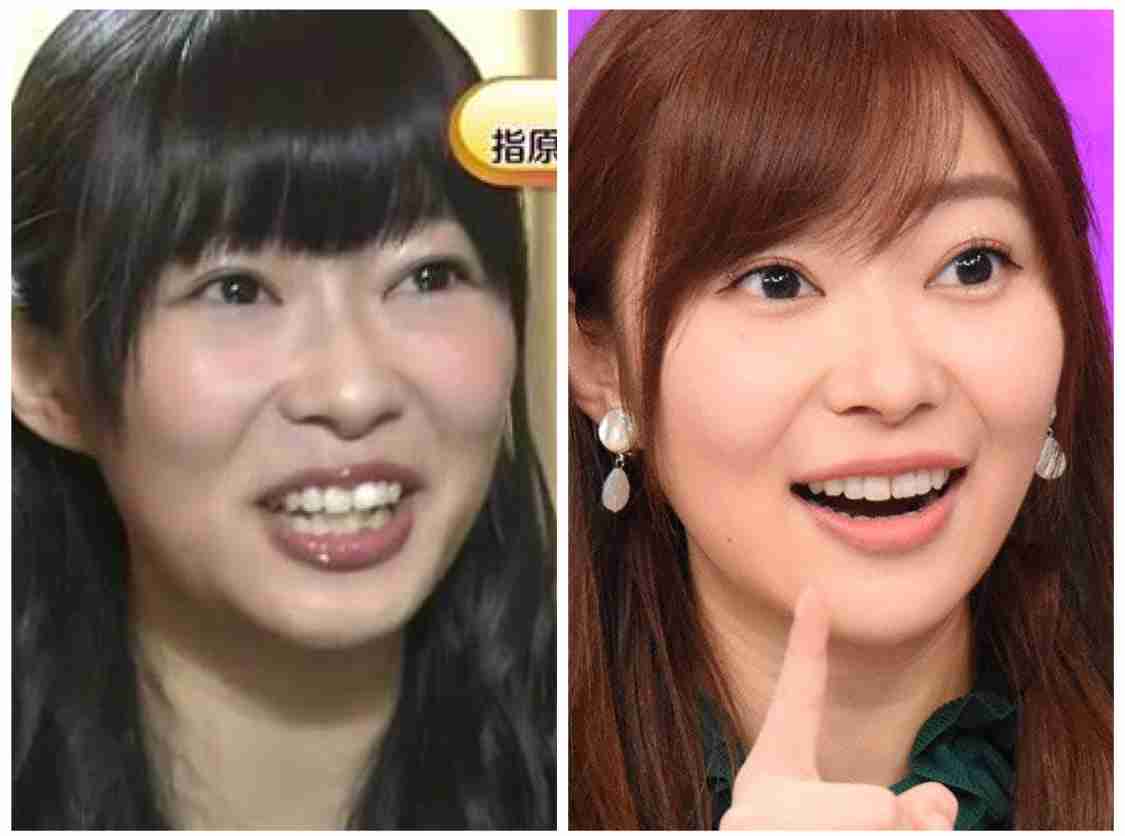 口元が気になる芸能人