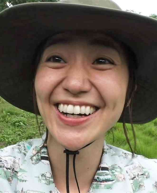 口元が気になる芸能人