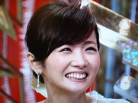 口元が気になる芸能人