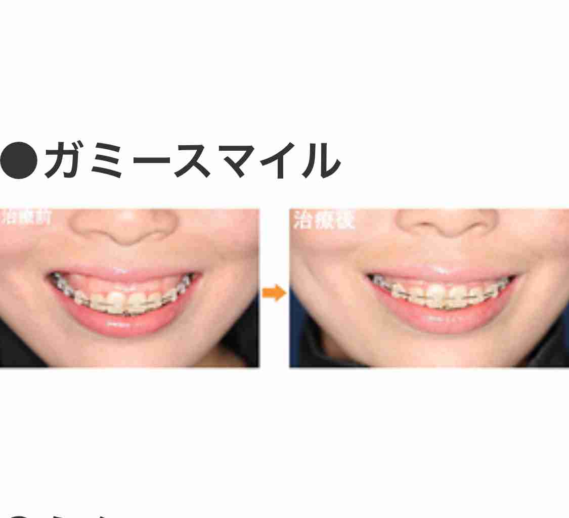 口元が気になる芸能人