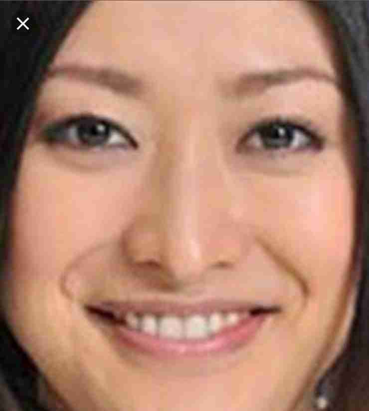 口元が気になる芸能人