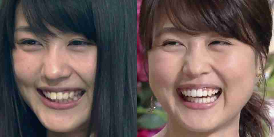 口元が気になる芸能人