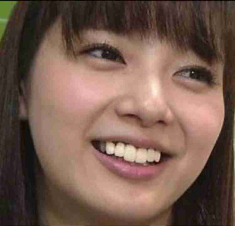 口元が気になる芸能人
