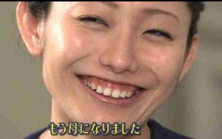 口元が気になる芸能人