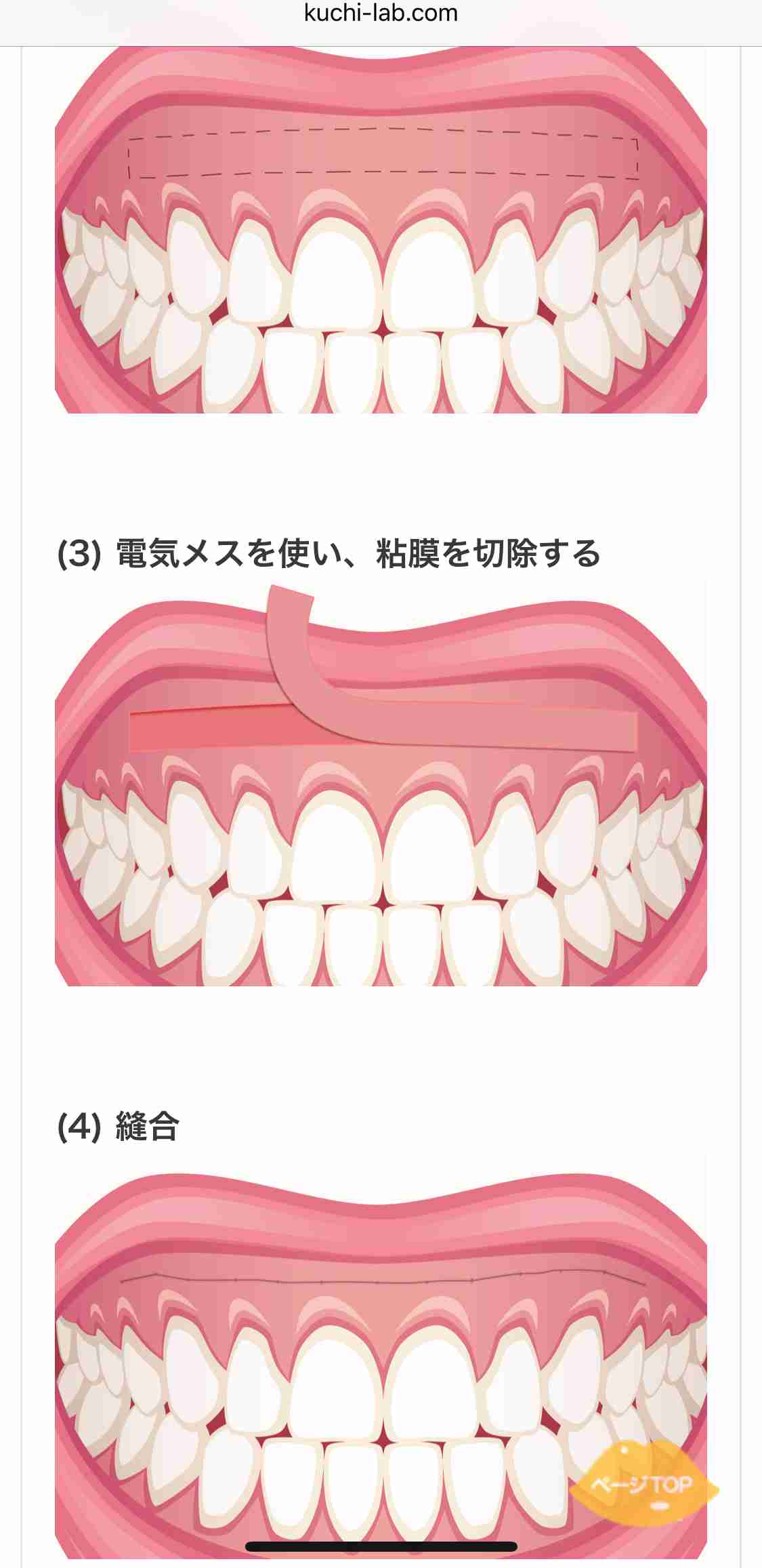 口元が気になる芸能人