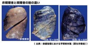 「どこで吸えばいいの」ベランダ喫煙トラブル、解決に限界 受動喫煙でうつ病リスクも