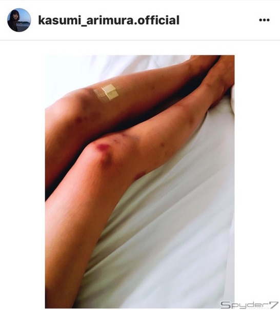 ｢あざとい｣がよくわからない
