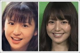 整形って言われるけど整形してないと思う芸能人