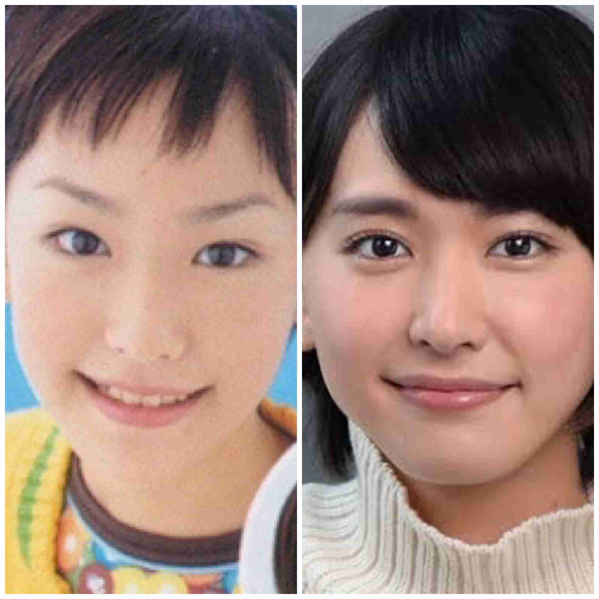 整形って言われるけど整形してないと思う芸能人
