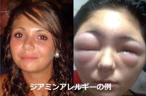市販の薬でヤバかった事