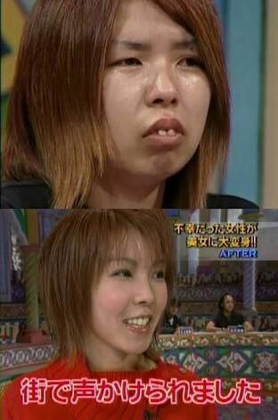 ブスは一体どうすればいいの？？