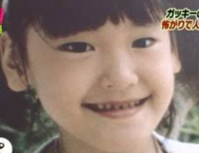 新垣結衣、「松田龍平との仲が怪しい」情報で芸能メディアが