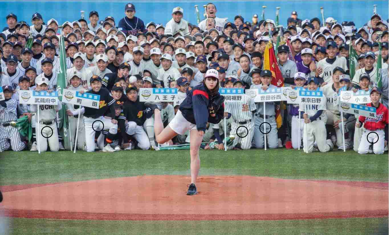 稲村亜美、骨折明かす「足首ひねってしまった」