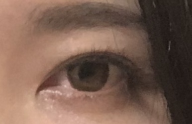 蒙古襞(もうこひだ)の利点