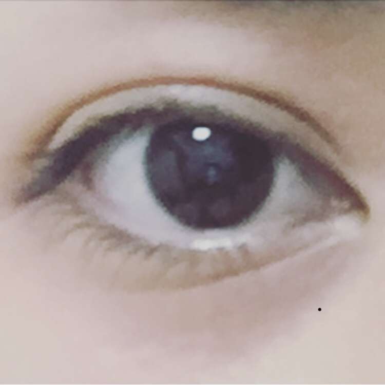 蒙古襞(もうこひだ)の利点