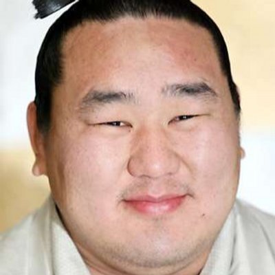 蒙古襞(もうこひだ)の利点