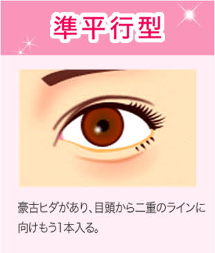 蒙古襞(もうこひだ)の利点