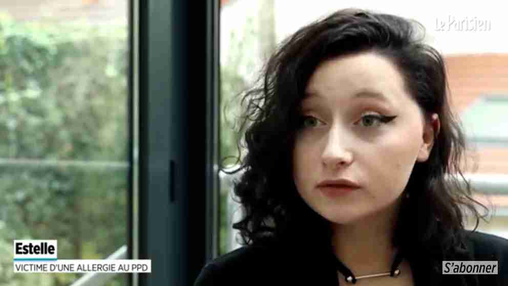 【閲覧注意】市販のヘアカラー剤を使った女性、頭が「電球」のように腫れ上がる