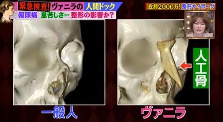 総額2億超