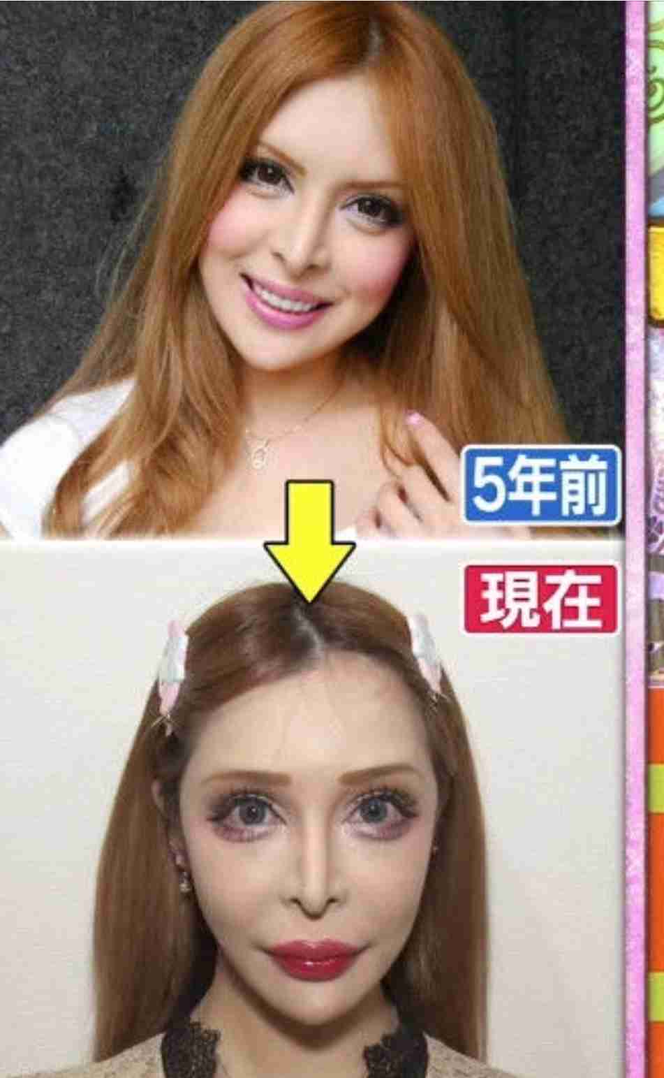 総額2億超