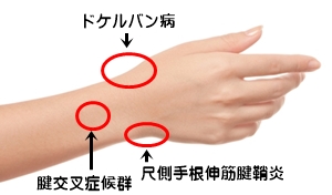 この症状、病院へ行くべき?