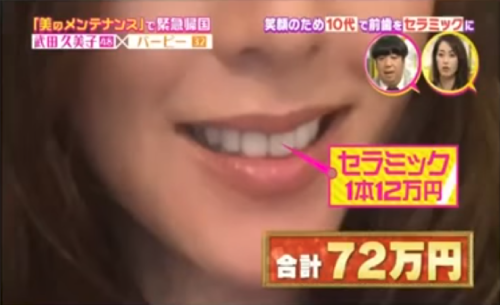 セラミックしたことある人