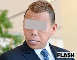 セラミックしたことある人