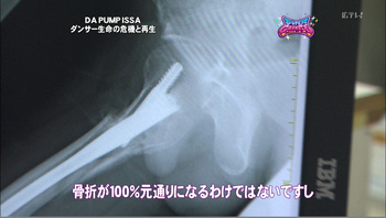 Issaの足の障害って 足を引きずる姿を深イイ話で公開 トレンドスパーク