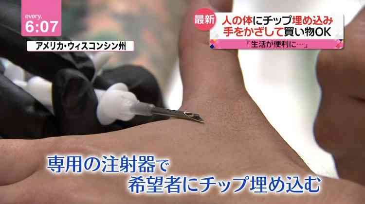 手の甲に極小チップ、埋めたい? 鍵や電子決済「便利」