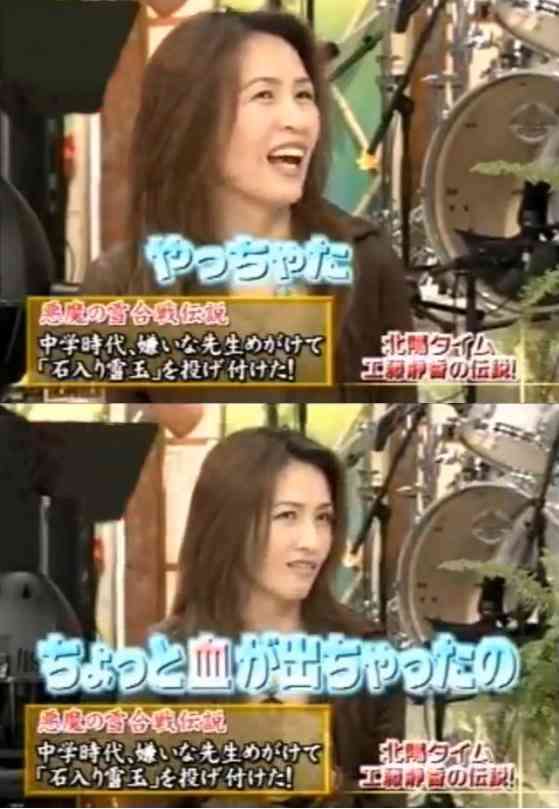 木村拓哉の急激な老け込みのワケを高須克弥院長が分析！