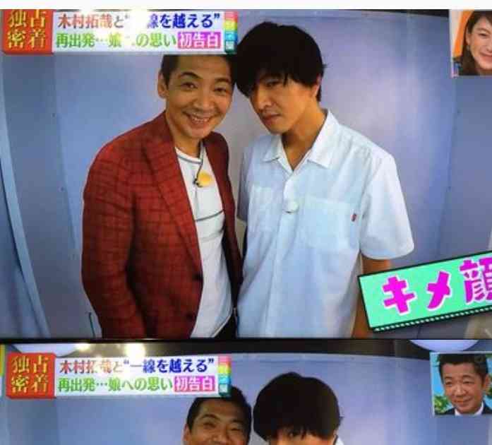 木村拓哉の急激な老け込みのワケを高須克弥院長が分析！
