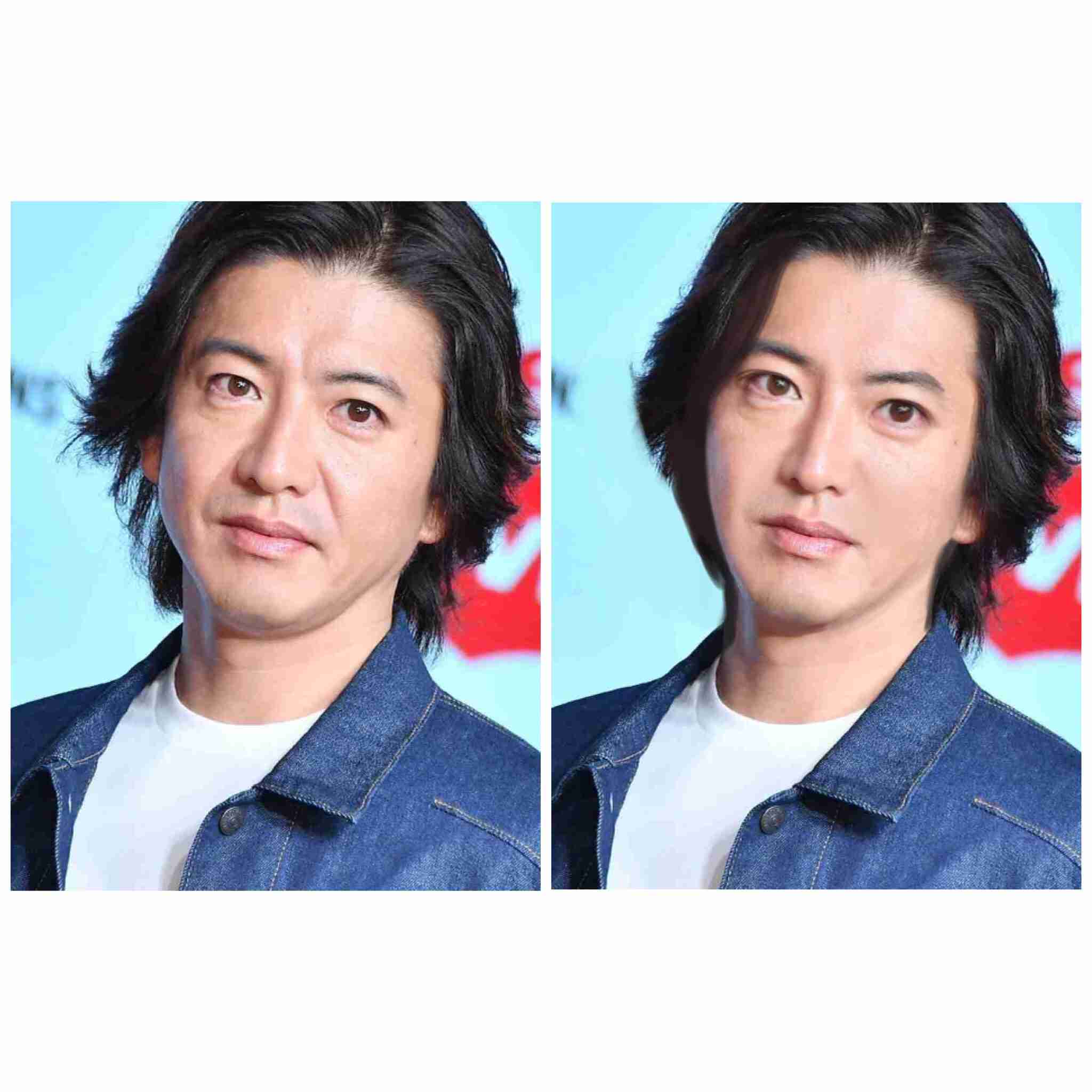 木村拓哉の急激な老け込みのワケを高須克弥院長が分析！