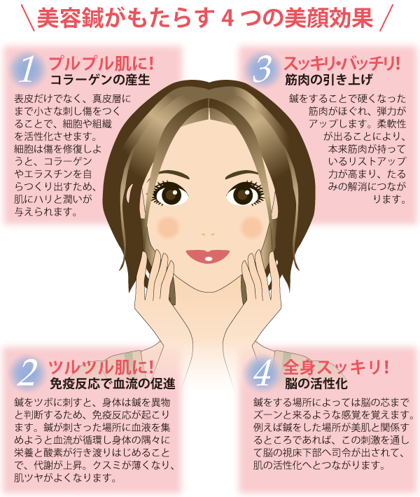 美容鍼に通ってる方 ガールズちゃんねる Girls Channel