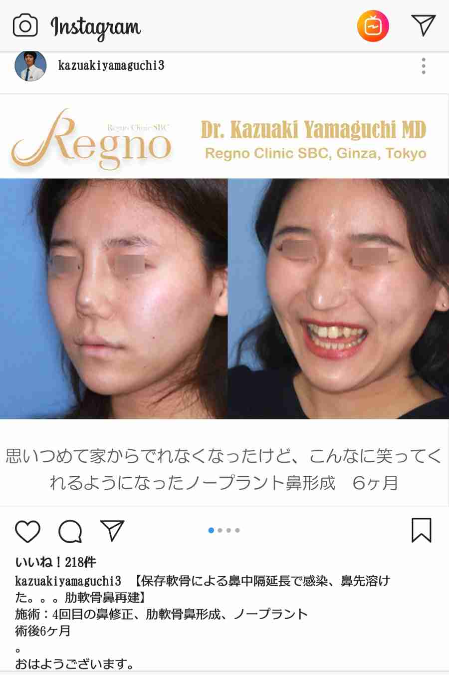 現役高校生の60%が「整形」に興味 したいのは「目」よりも「鼻」