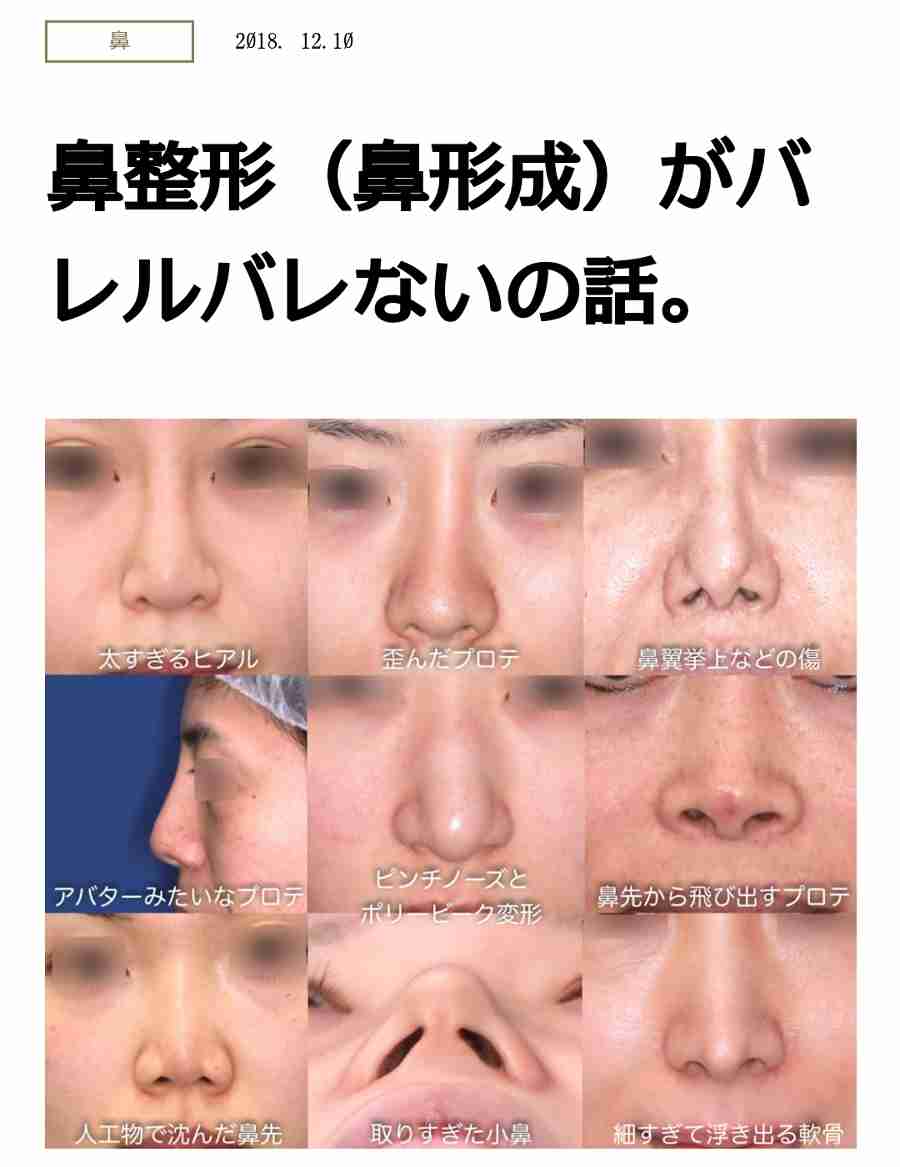 現役高校生の60%が「整形」に興味 したいのは「目」よりも「鼻」
