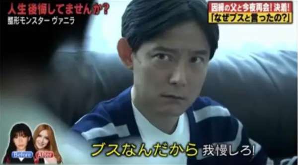 現役高校生の60%が「整形」に興味 したいのは「目」よりも「鼻」