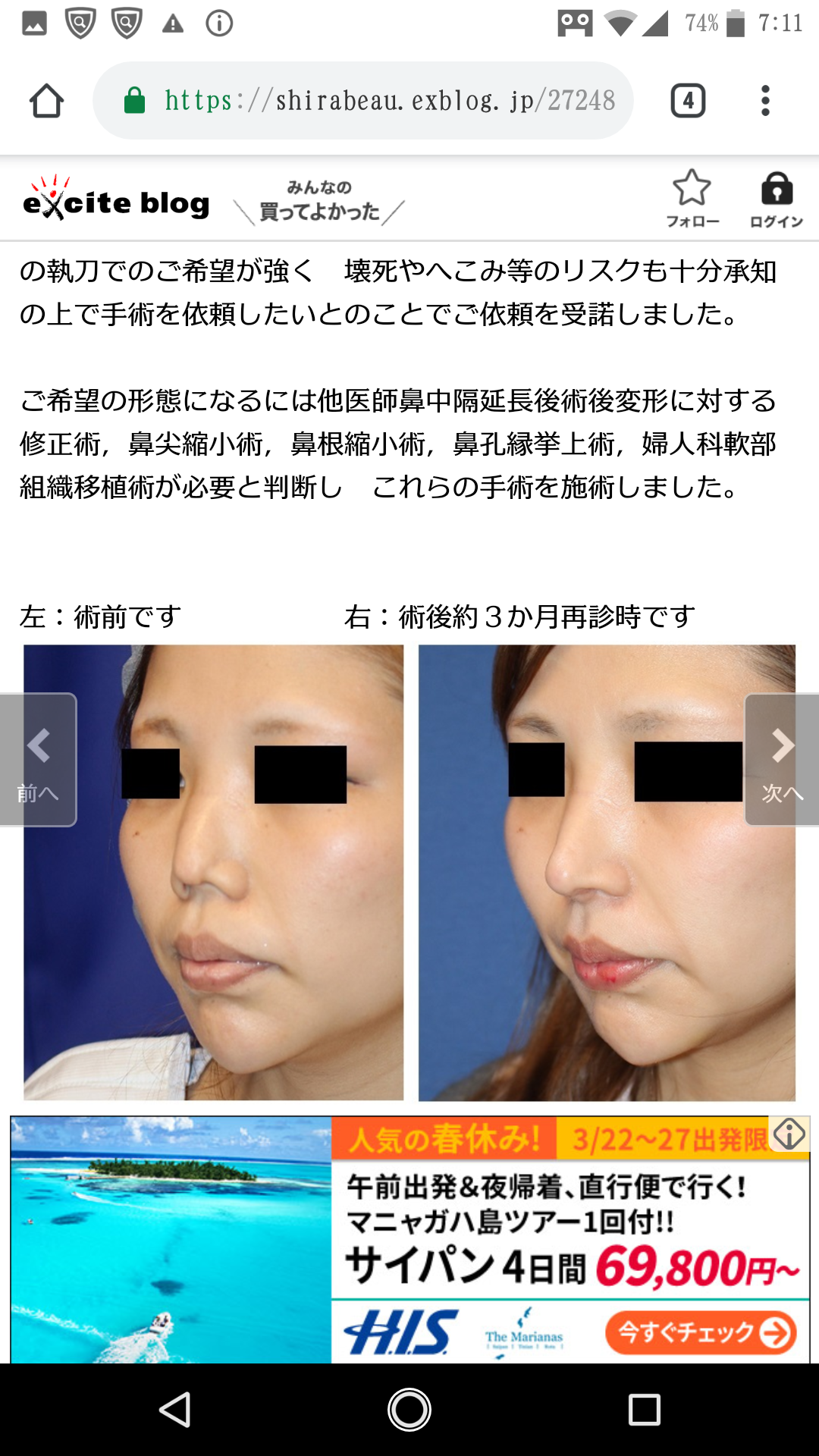 現役高校生の60%が「整形」に興味 したいのは「目」よりも「鼻」
