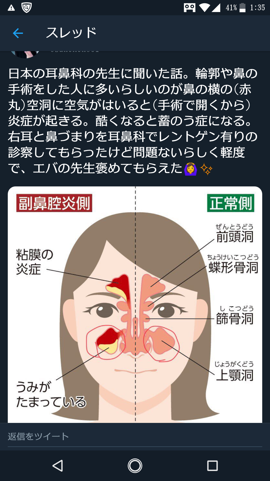現役高校生の60%が「整形」に興味 したいのは「目」よりも「鼻」