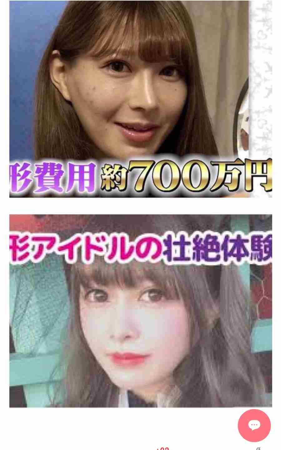 現役高校生の60%が「整形」に興味 したいのは「目」よりも「鼻」