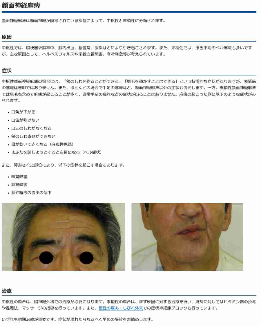 現役高校生の60%が「整形」に興味 したいのは「目」よりも「鼻」