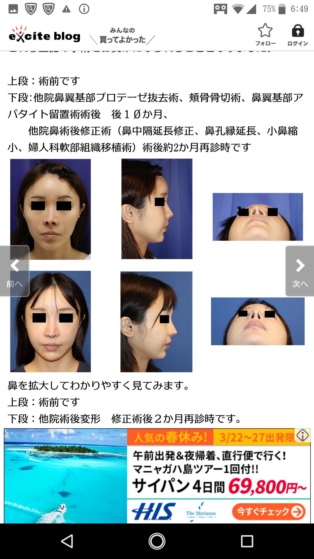 現役高校生の60%が「整形」に興味 したいのは「目」よりも「鼻」