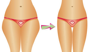 1番痩せたい部分はどこですか？