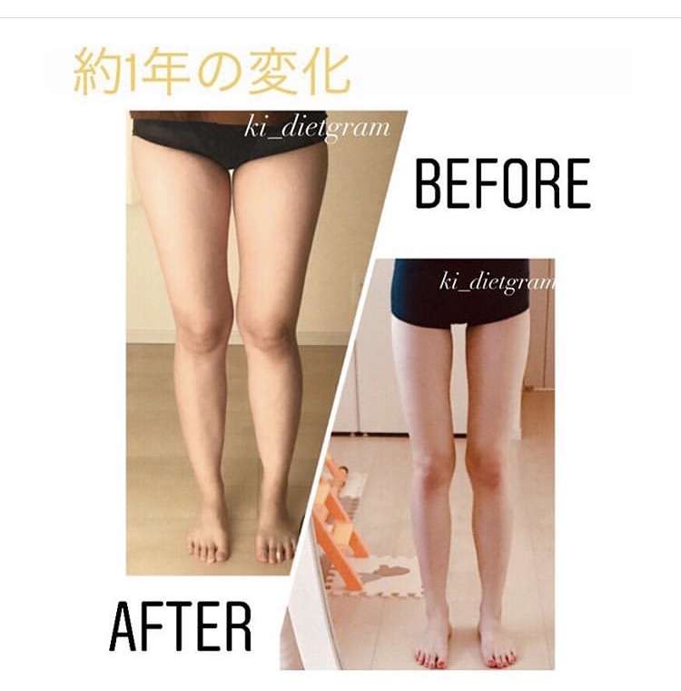 1番痩せたい部分はどこですか？