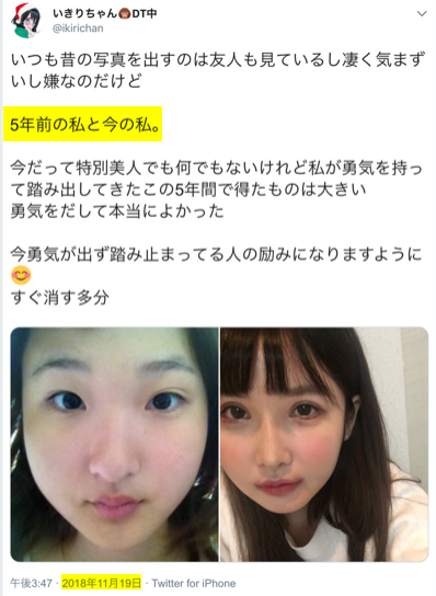 整形SNS美女、手術費1500万円　きっかけは父の一言「お前の顔は他人を不幸にする」